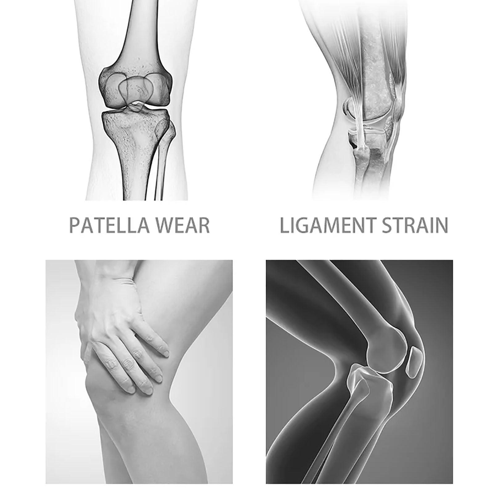 Reyneey Reyneey Griqos Knee Braces for Knee Pain, Griqos Limitless Knee Pro Sleeve Brace for Knee Pain Bone on Bone, Knee Compression Sleeve with Patella TPE Pad & Side Stabilizers for Women Men (1*White, S)