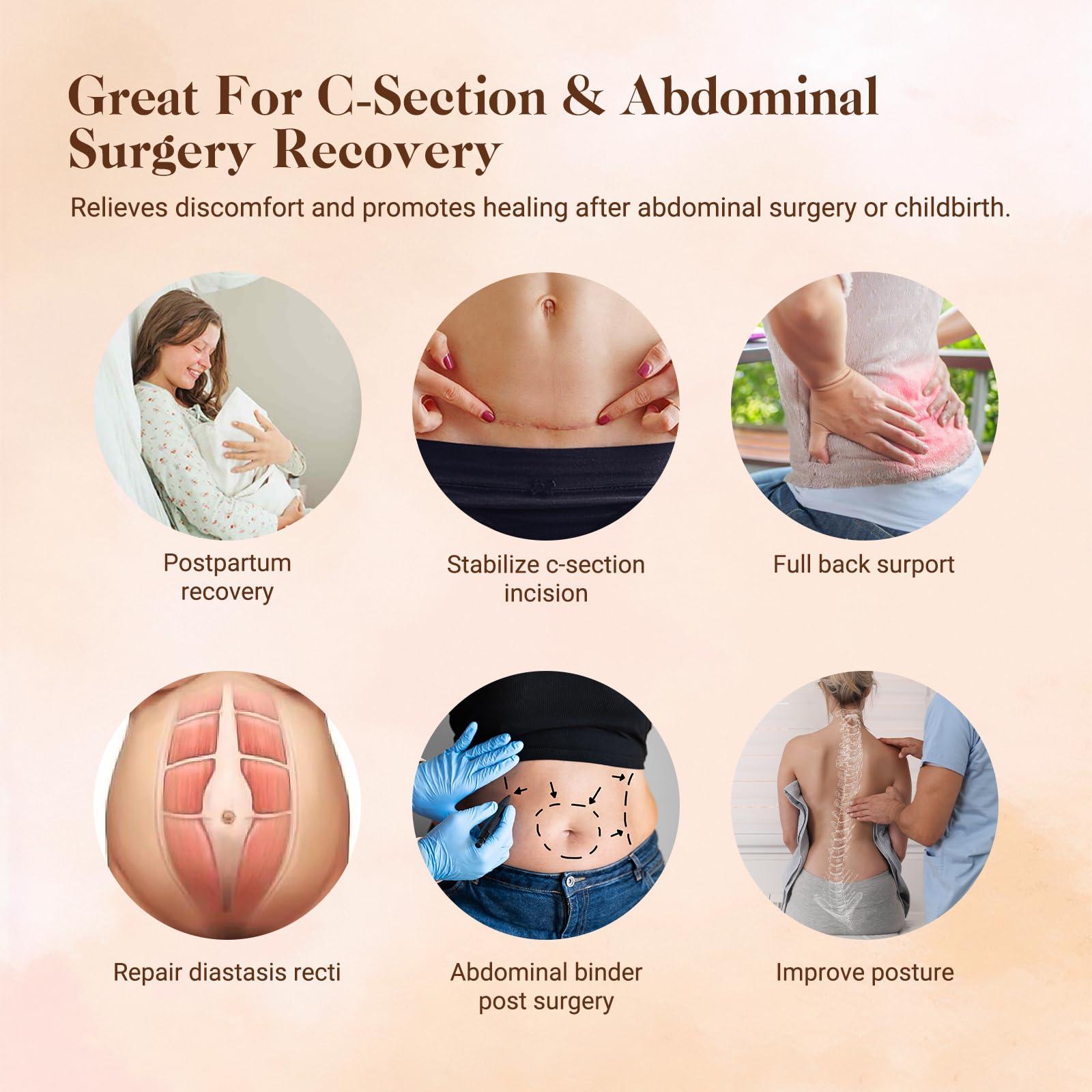 Trendyline Trendyline Postpartum Belly Band for Women: Abdominal Binder Post Surgery Stomach Compression Support Belt - Post Partum Waist Girdle C Section Recovery Wrap Black