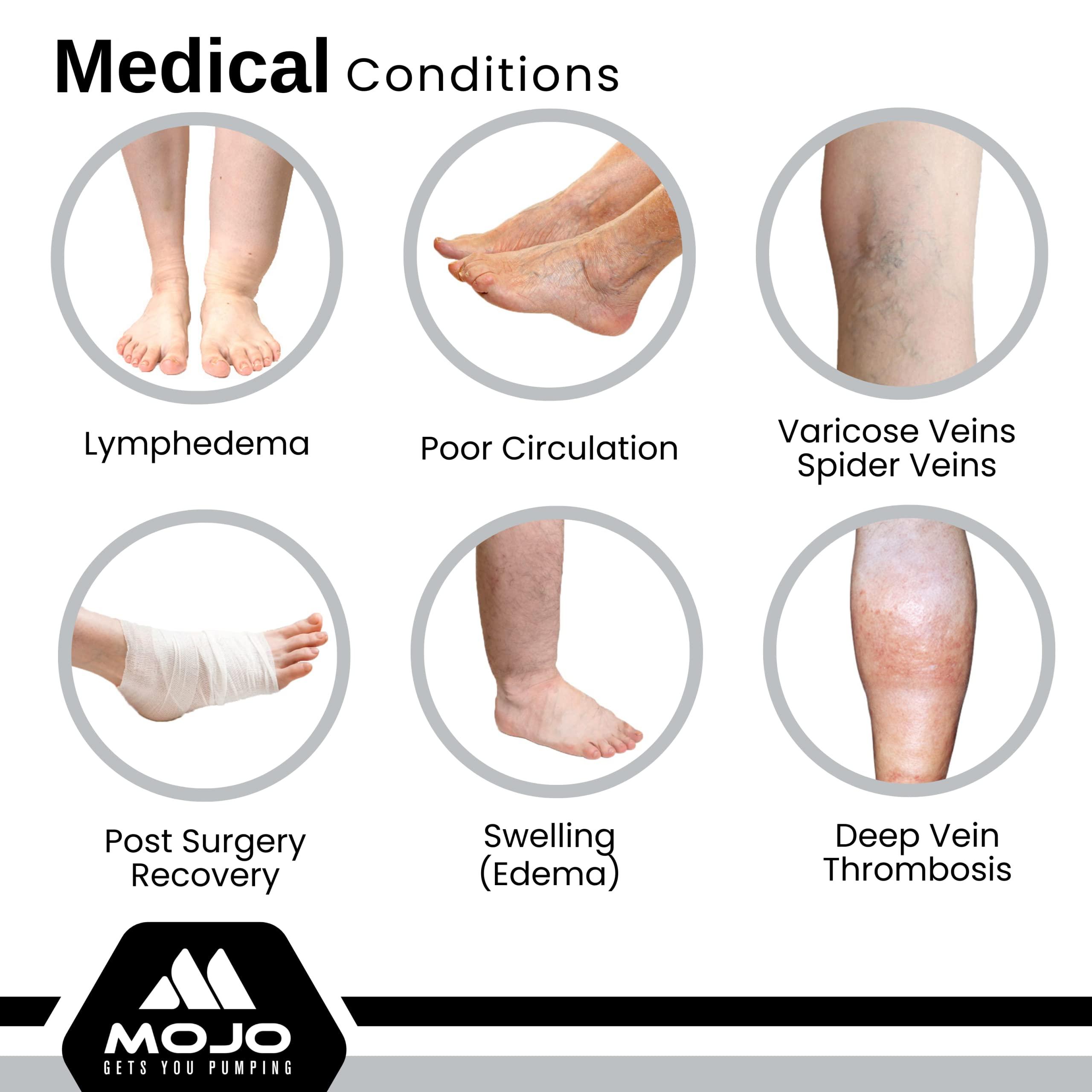 Mojo Compression Socks Mojo Compression Sleeve for Women and Men 20-30mmHg Plus Size - Men and Womens Footless Compression Socks for Travel, Airplane, Sports - Black, 6X-Large - A604
